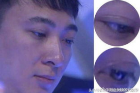 做过双眼皮的男明星